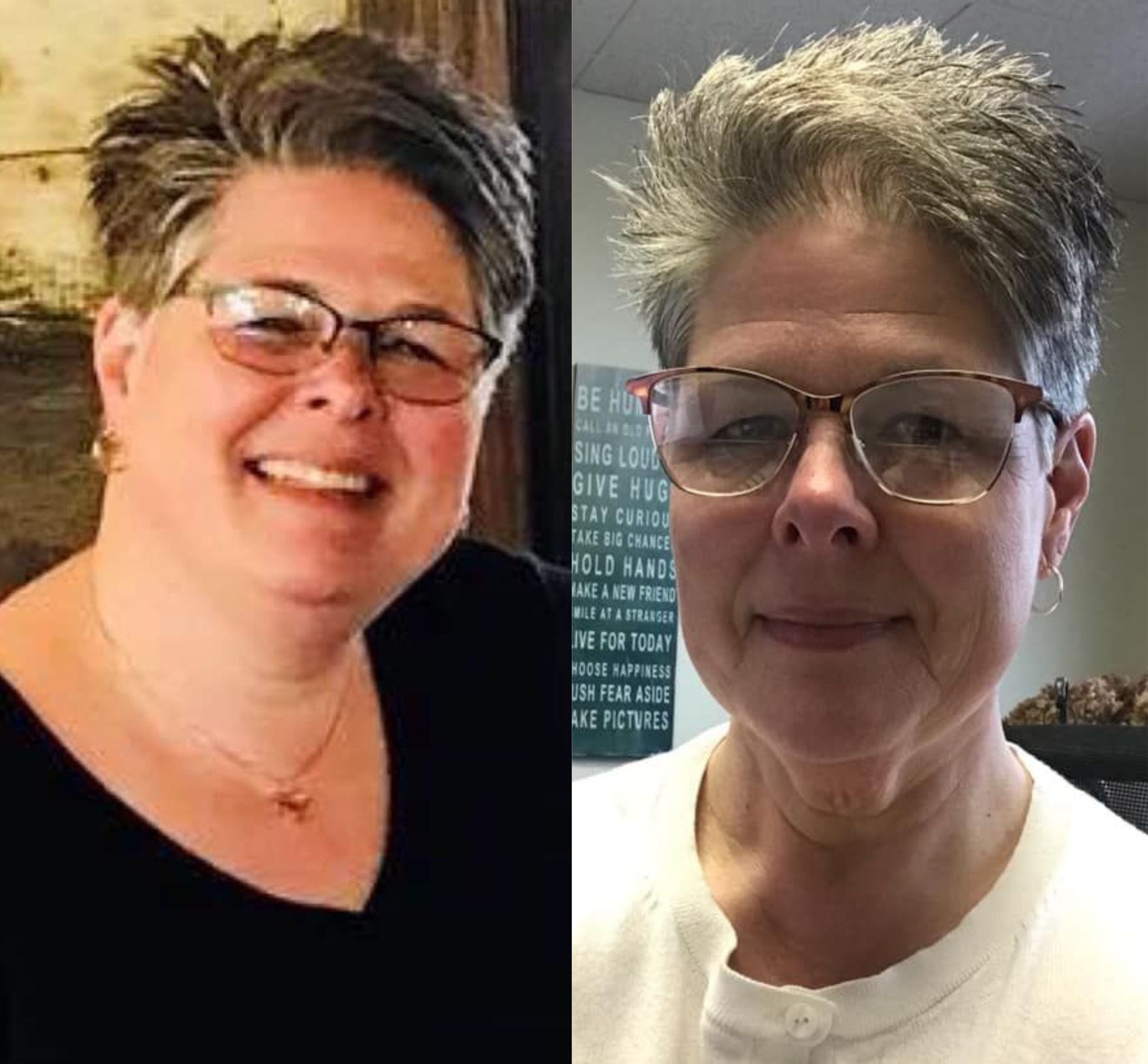 Two photos of a woman with glasses before and after her weight loss surgery.
