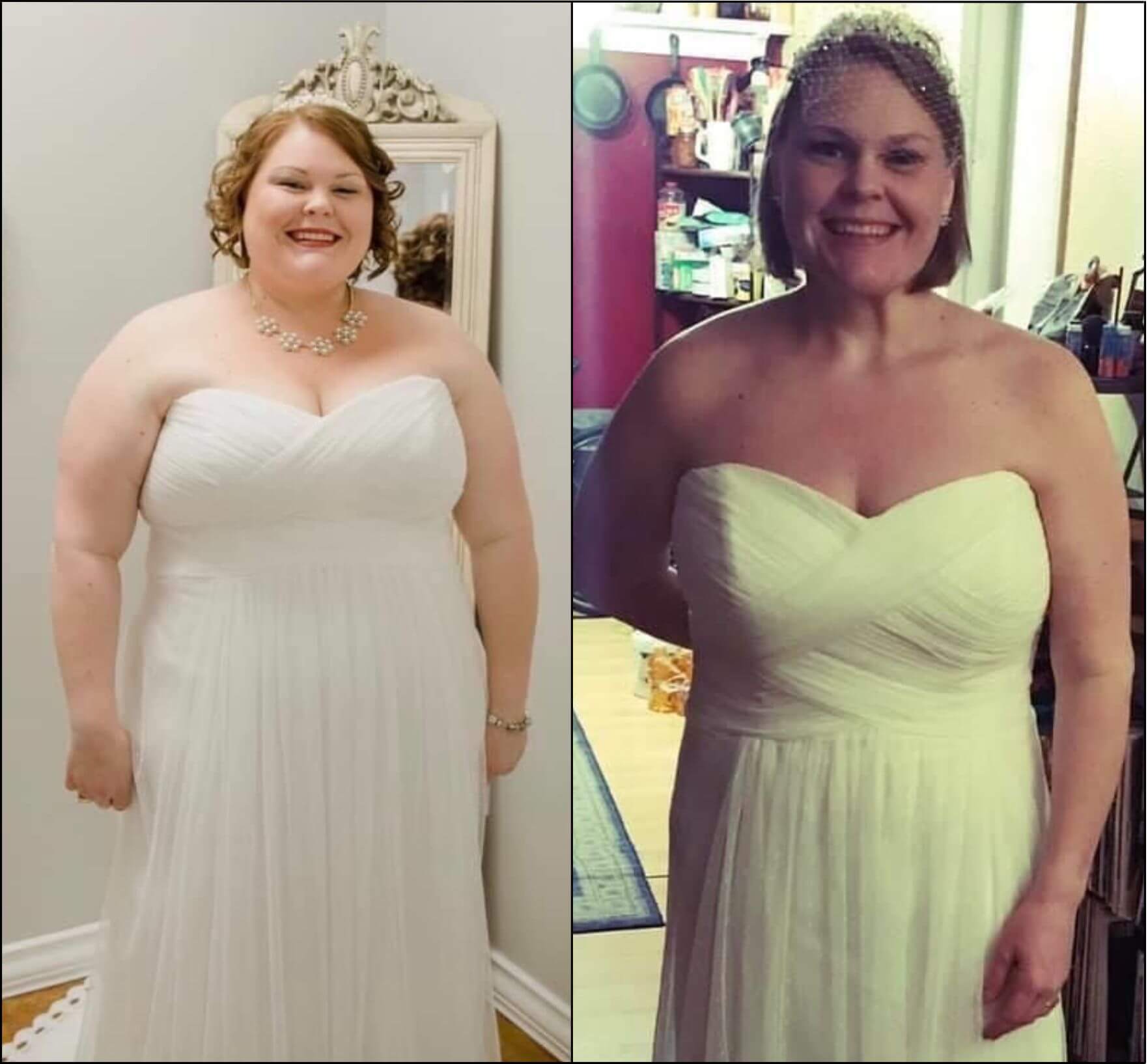 A woman in a wedding dress before and after weight loss
