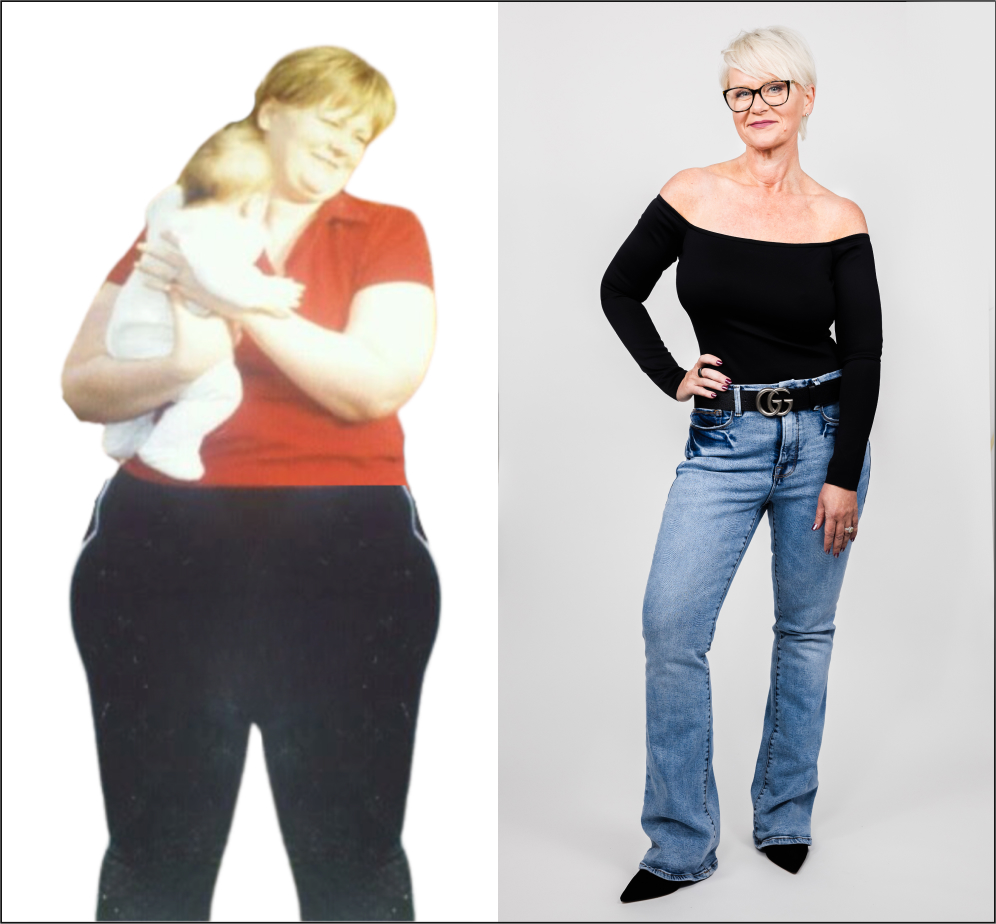 A woman is posing before and after a weight loss.