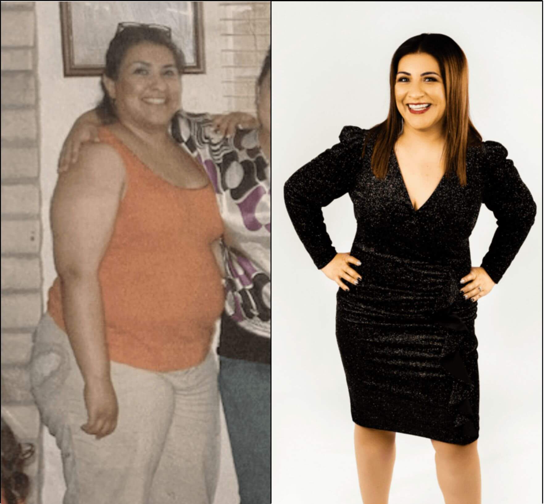 Two photos of a woman before and after weight loss.
