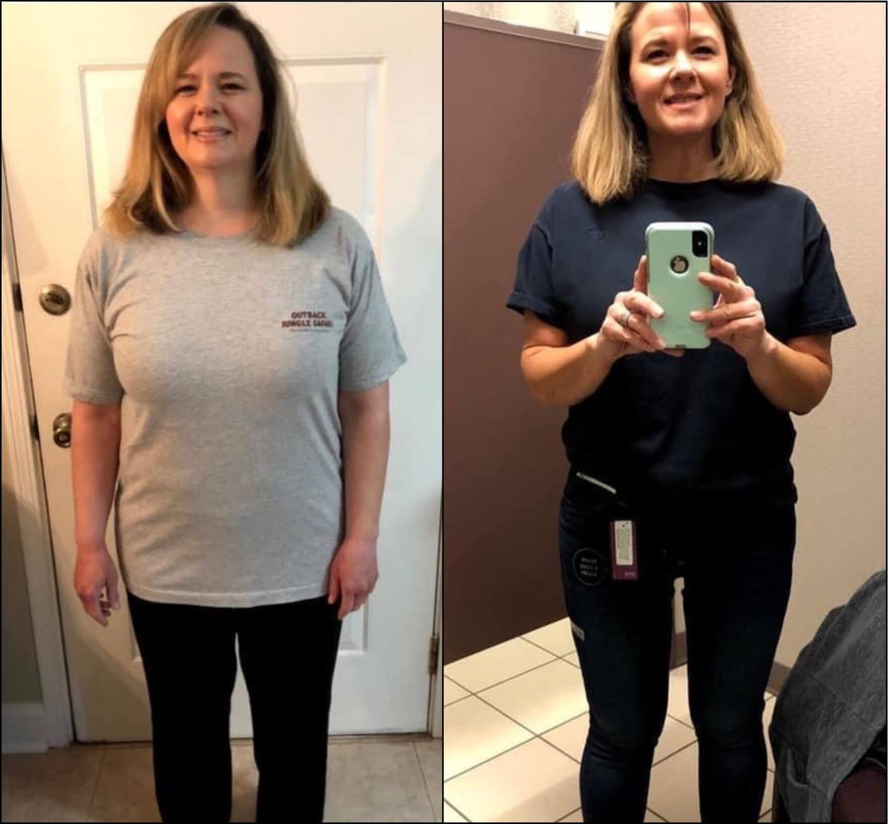 Two pictures of a woman before and after her weight loss.