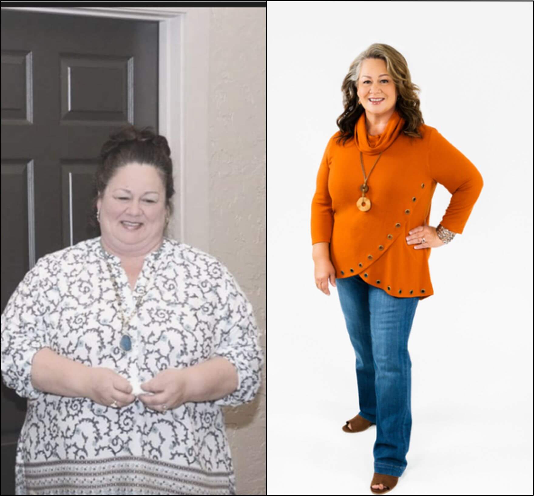 Two pictures of a woman before and after weight loss.