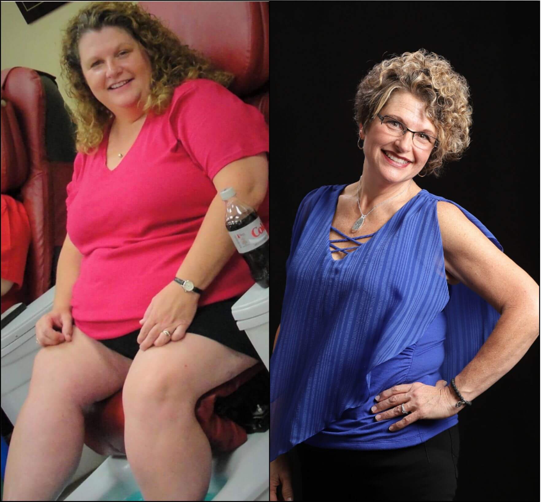 Two pictures of a woman before and after a weight loss program.