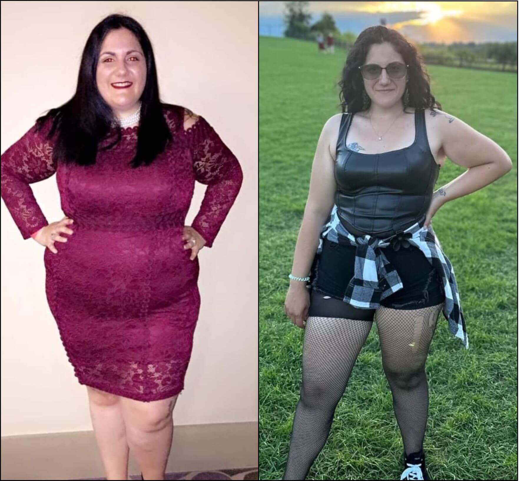 Two pictures of a woman posing before and after a weight loss.