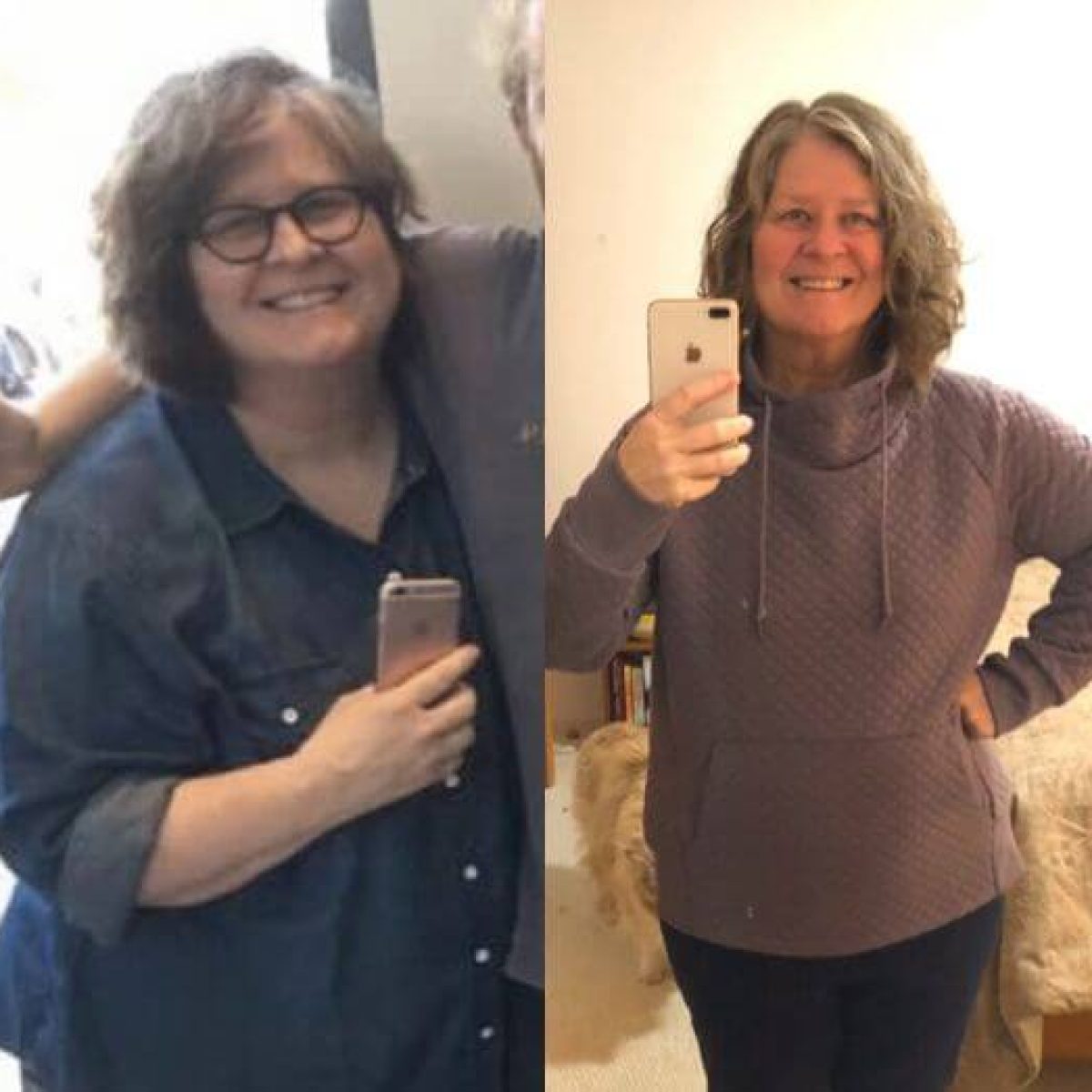 Two pictures of a woman before and after her weight loss.