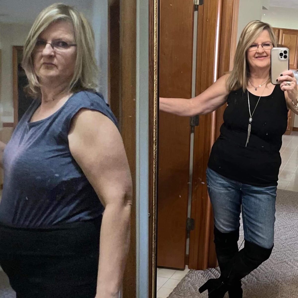 Sandy - A woman takes a picture of herself before and after losing weight